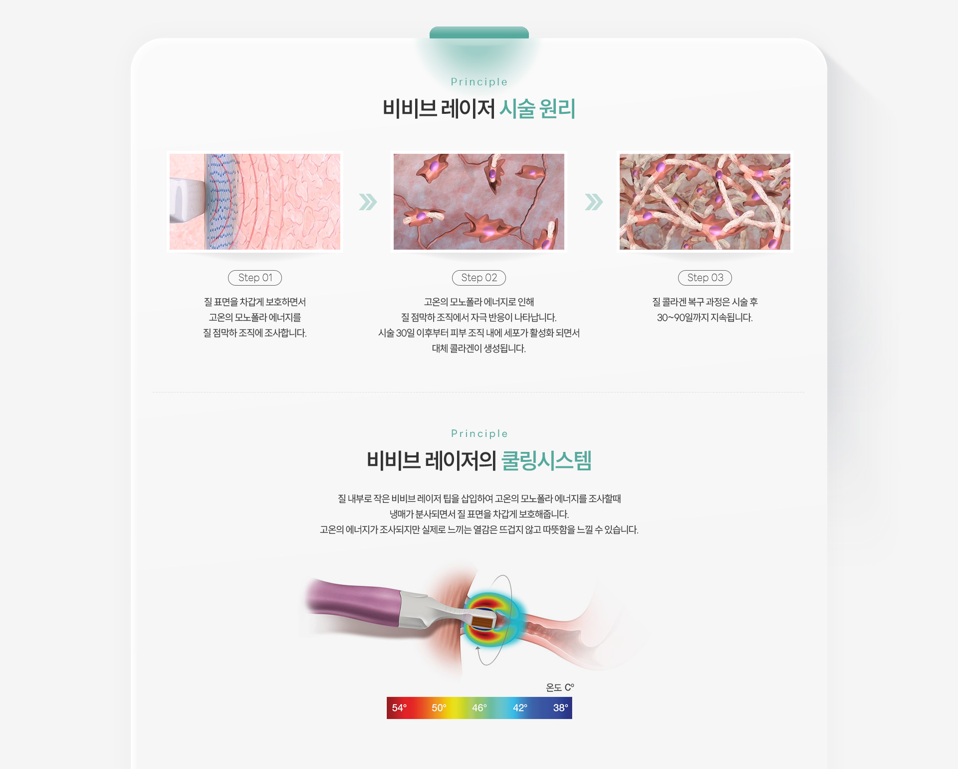질레이저 시술원리