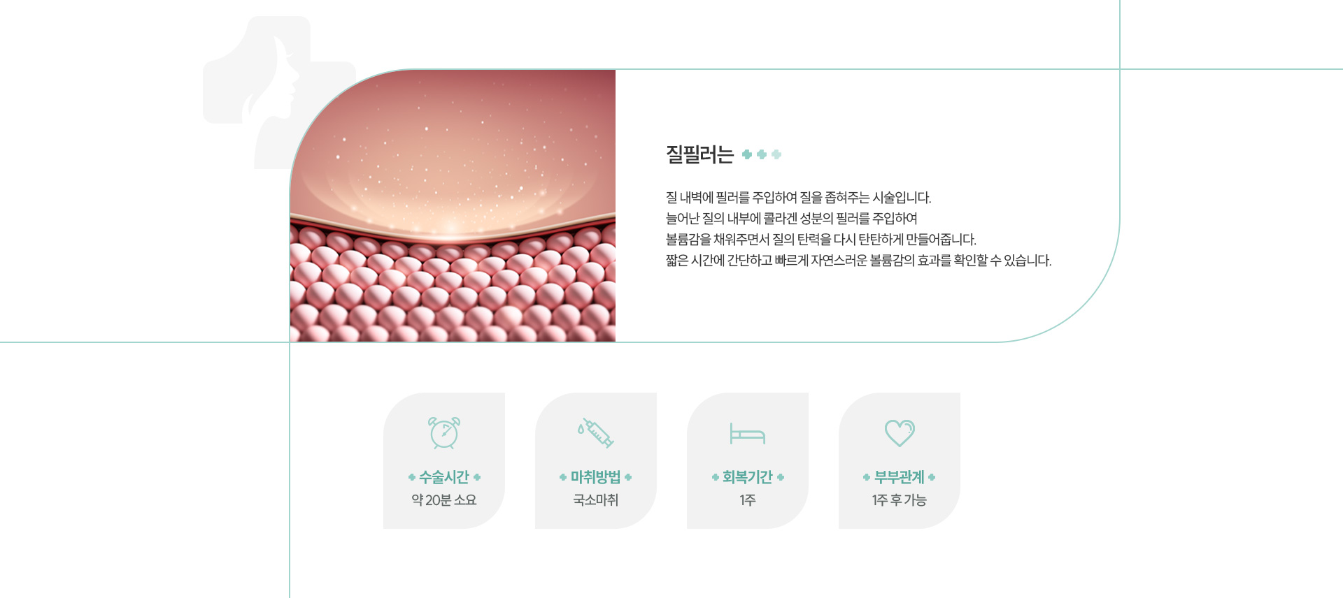 질필러 정의