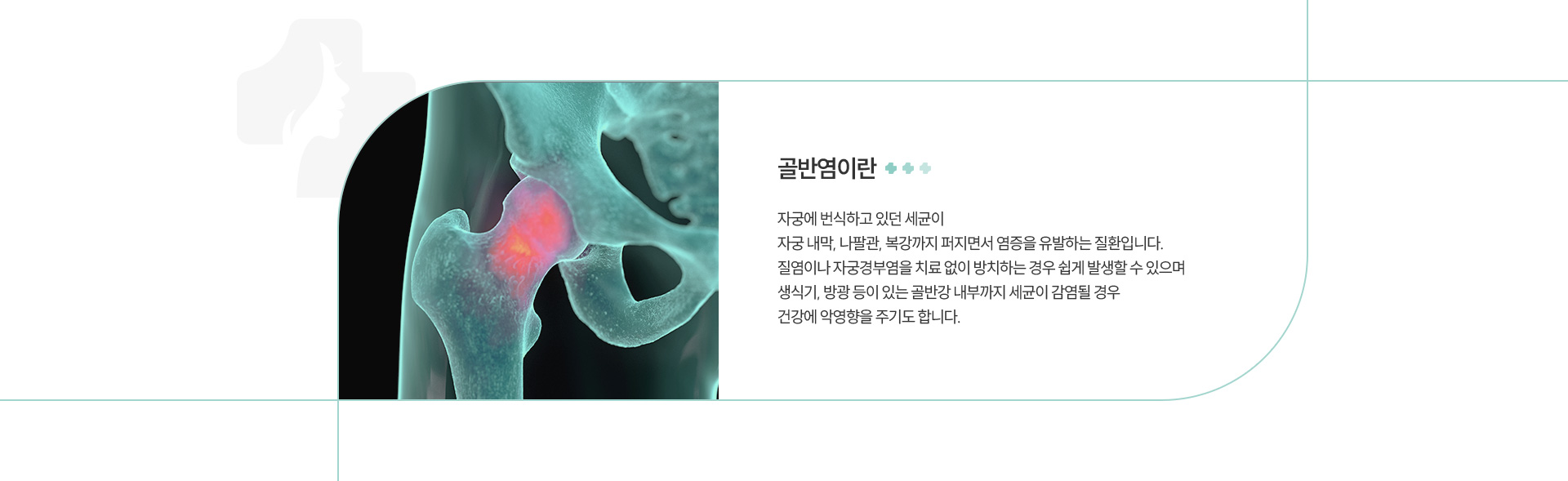 골반염 정의