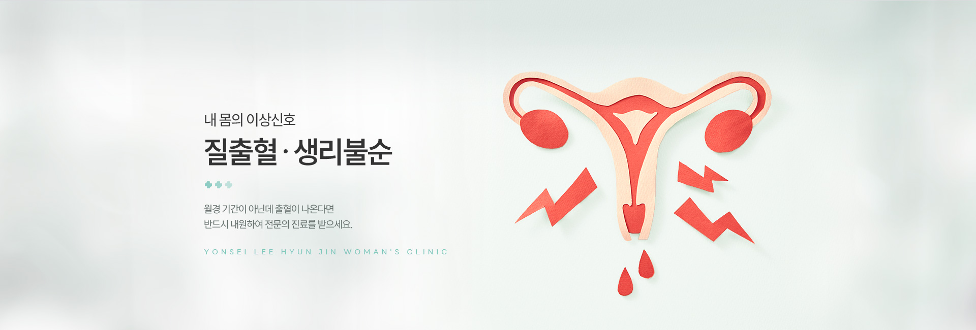 질출혈/생리불순 키비주얼