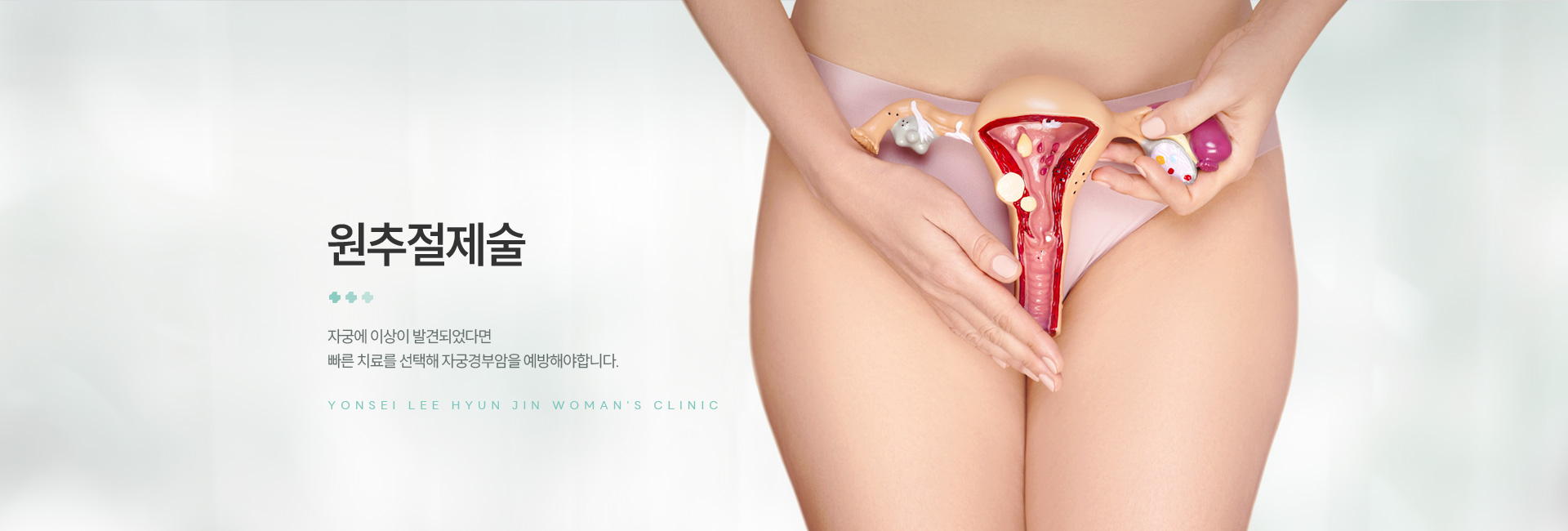 원추절제술 키비주얼