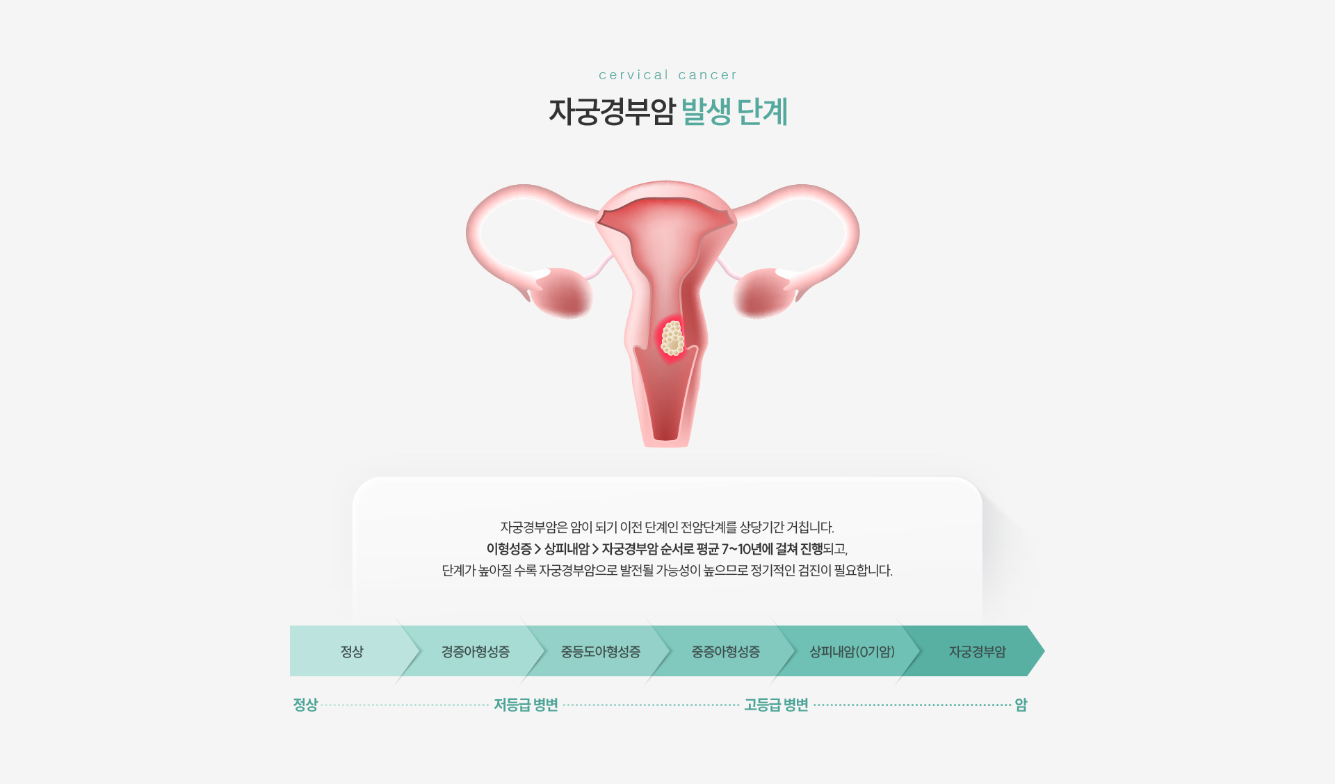 원추절제술 발생단계
