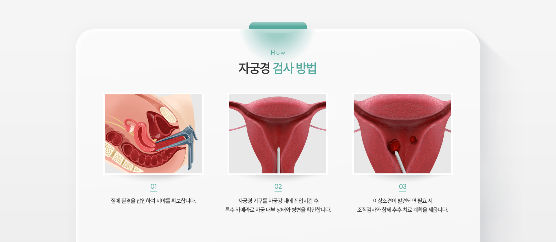 연성자궁경 검사방법